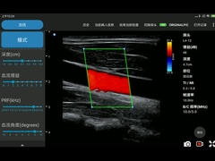 arsenal linear electrónico Iphone de los escáneres inalámbricos del ultrasonido de 12MHz