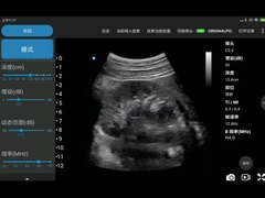 El CE marcó png portátil MPEG-4 del BMP del JPEG de los escáneres del ultrasonido de 3.6MHz Wifi