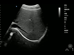 Escáner convexo de la salud del PDA de la punta de prueba del aparato médico portátil ISO13485