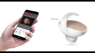 Marvoto Fetus Camera M1- Ultrasonido portátil 3D