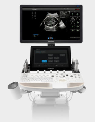 comprar La inteligencia artificial basó la carretilla P60 Exp de la máquina del ultrasonido de SonoScape online manufacture
