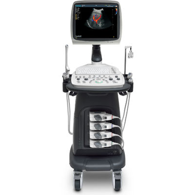 comprar Carretilla portátil S12 del ultrasonido de la proyección de imagen de SonoScape de la máquina fetal del ultrasonido online manufacture