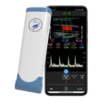 comprar Escáner de ultrasonido portátil inalámbrico de 12 MHz para iPhone y iPad | Sonda Doppler color de matriz lineal electrónica online manufacture