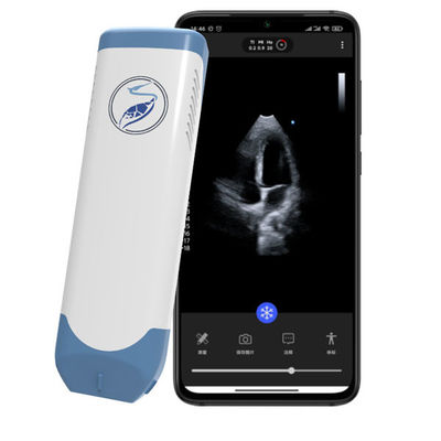 comprar Escáner de ultrasonido portátil inalámbrico en fase, ultrasonido cardíaco de bolsillo de 5MHz para ecocardiografía POCUS online manufacture