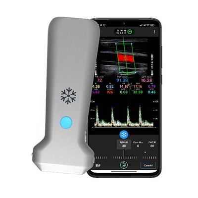 comprar Escáner de ultrasonido Doppler color portátil lineal inalámbrico WiFi | Imágenes en tiempo real de 30 FPS | Sonda de ultrasonido médico portátil online manufacture