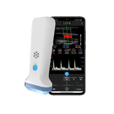 comprar Escáner de ultrasonido portátil lineal inalámbrico | Sonda de ultrasonido Doppler color portátil de 4/8,3/12MHz online manufacture