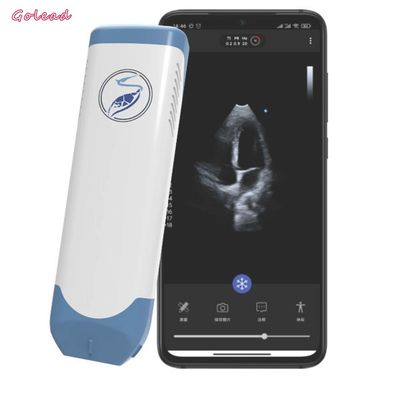 comprar punta de prueba inalámbrica portátil del ultrasonido 3.6MHz organizada - transductor del arsenal online manufacture