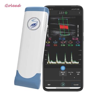 comprar Escáner portátil inalámbrico electrónico 12MHz del ultrasonido de Wifi del arsenal linear online manufacture