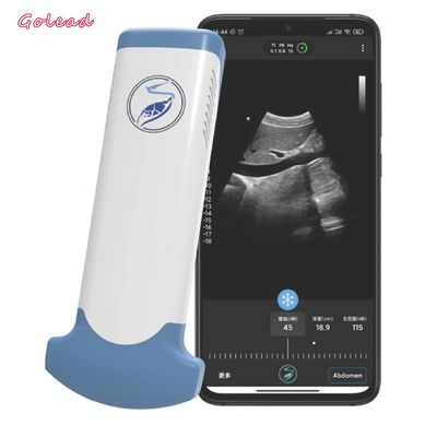 comprar Dispositivo inalámbrico del ultrasonido del arsenal convexo electrónico para el teléfono móvil online manufacture