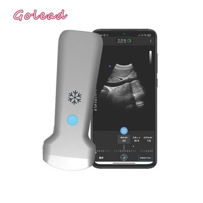comprar El CE aprobó el ultrasonido cardiaco convexo electrónico de la punta de prueba del arsenal USG para Android online manufacture