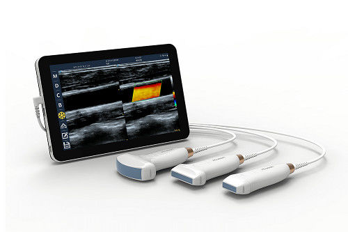 comprar Escáner de ultrasonido portátil lineal USB tipo C, sonda de ultrasonido portátil Android de 10MHz para Vascular y POCUS online manufacture