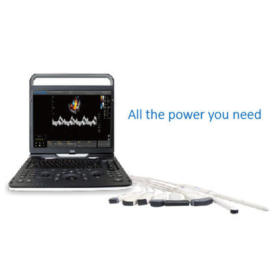 comprar Ultrasonido Chison EBit 60 de Wifi de 128 elementos para cardiovascular online manufacture