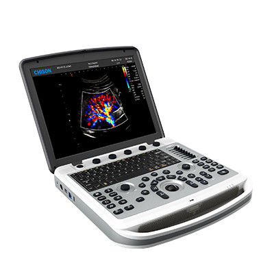 comprar Máquina portátil del ultrasonido del ordenador portátil de 120° Chison SonoBook 6 rotativos online manufacture