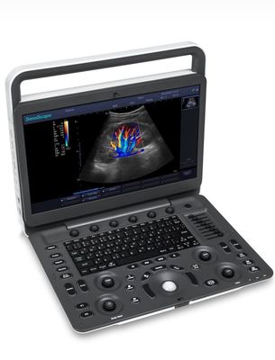 comprar ultrasonido de BW de la máquina del ultrasonido de 15.6inch LED Sonoscape E1 Exp online manufacture