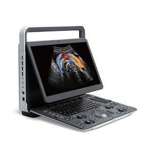 comprar Máquina portátil panorámica del ultrasonido de SonoScape E2 de la proyección de imagen FAVORABLE online manufacture
