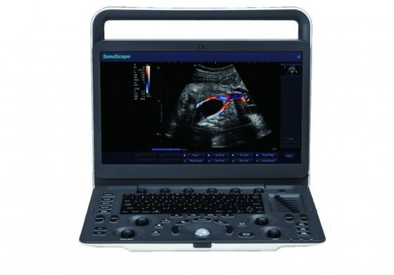 comprar 7 máquina portátil del ultrasonido de SonoScape E3 de los niveles de la proyección de imagen con el monitor de 15,6 pulgadas online manufacture