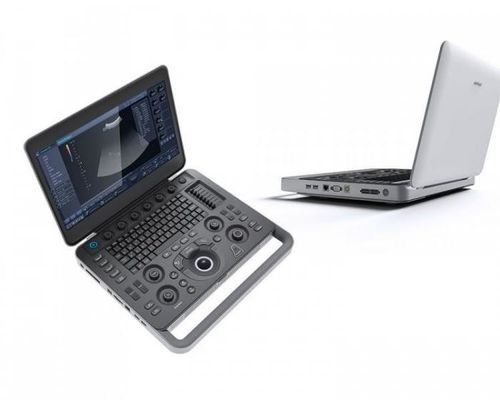 comprar Smart ve la máquina del ultrasonido de SonoScape del ordenador portátil 500GB con 15,6” LCD online manufacture
