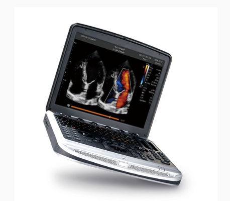 comprar Máquina aprobada por la FDA Chison SonoBook 8 del ultrasonido del ordenador portátil para la ecocardiografía online manufacture