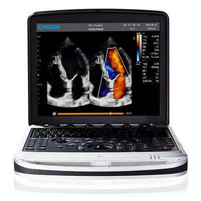 comprar Fácil llevar la máquina del ultrasonido del ordenador portátil de 4D Chison SonoBook 9 online manufacture