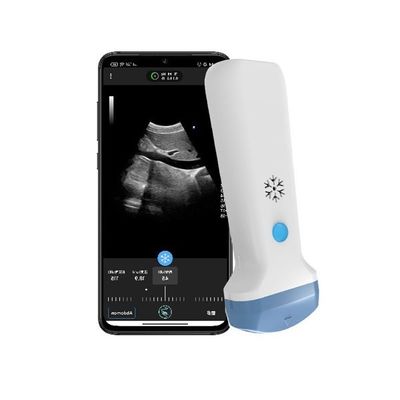comprar Escáner de ultrasonido portátil convexo inalámbrico con salida HDMI | Ultrasonido POCUS Doppler color portátil de 3,6 MHz online manufacture