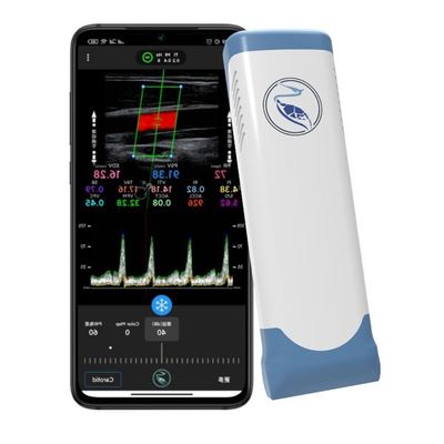 comprar Capítulos del escáner 100 del ultrasonido de Echo Color Doppler Wireless Handheld online manufacture