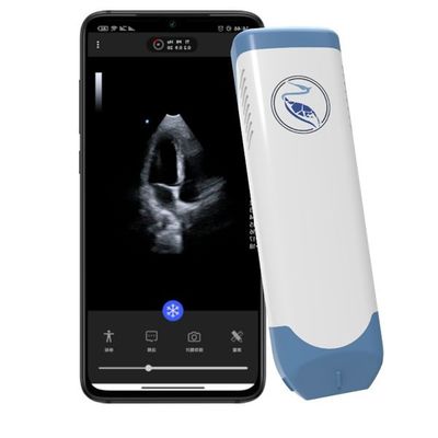 comprar Escáner del ultrasonido del PDA de la profundidad el 18.9cm para Iphone 3.6MHz online manufacture