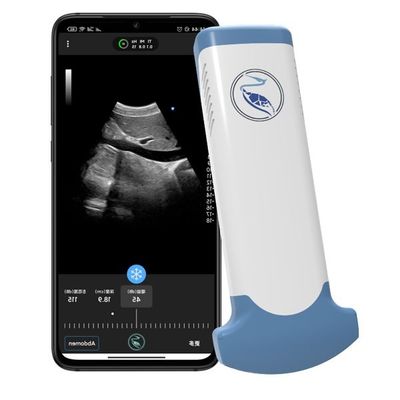 comprar Escáner del ultrasonido del PDA de la medicina MPEG-4 de la emergencia para el uso de diagnóstico clínico online manufacture