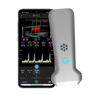 comprar Escáner de ultrasonido portátil lineal inalámbrico con certificación CE | Sonda de ultrasonido Doppler color portátil de 8,3 MHz online manufacture