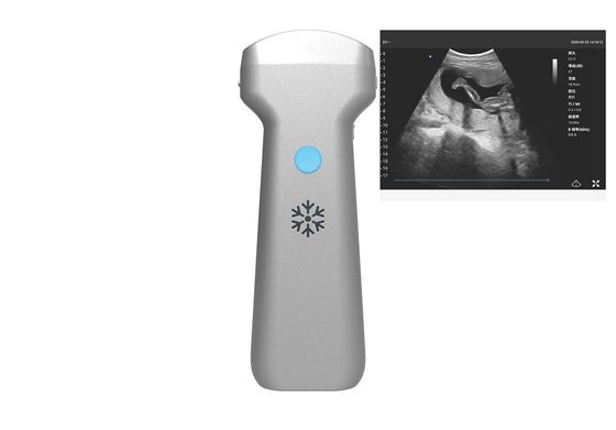 comprar Punta de prueba inalámbrica convexa 2MHz 3.6MHz 5MHz del ultrasonido del arsenal convexo electrónico online manufacture