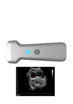 comprar Punta de prueba inalámbrica convexa del ultrasonido de Ultrasonication para ginecología online manufacture