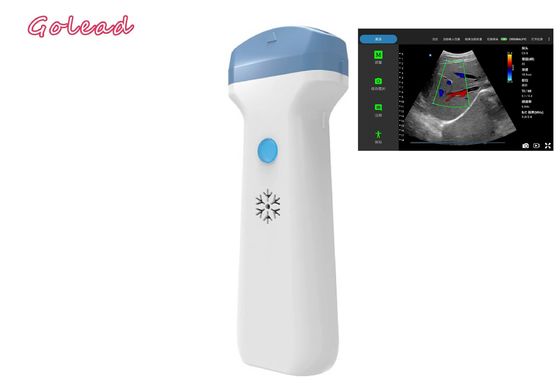 comprar Punta de prueba inalámbrica del ultrasonido de Ipad de la anestesia para la atención primaria de los exámenes de POCUS online manufacture