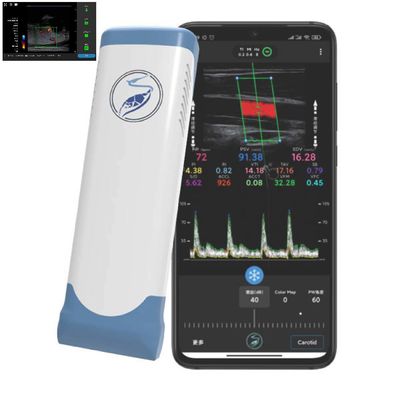 comprar 256 líneas de exploración punta de prueba inalámbrica del ultrasonido del transductor del ultrasonido de Ipad para PICC online manufacture