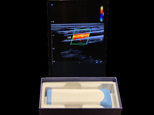 comprar Escáner avanzado de ultrasonido de mano 0.2 kg con batería de 3000 mAh para uso médico online manufacture