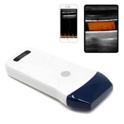 comprar Escáner de ultrasonido de sonda lineal inalámbrico para acceso vascular, bloqueo nervioso e imágenes musculoesqueléticas online manufacture