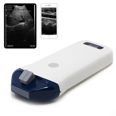 comprar Sistema de ultrasonido portátil inalámbrico para guía de agujas y procedimientos intervencionistas online manufacture