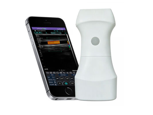 comprar Sonda de ultrasonido de bolsillo de 192 elementos: imágenes POCUS profesionales de alta resolución en la palma de su mano. online manufacture