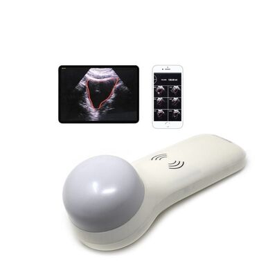 comprar Escáner de vejiga portátil inalámbrico 4D para medición del volumen urinario en el lugar de atención online manufacture