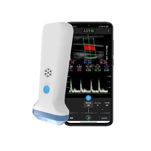 Escáner de ultrasonido portátil lineal inalámbrico | Sonda de ultrasonido Doppler color portátil de 4/8,3/12MHz
