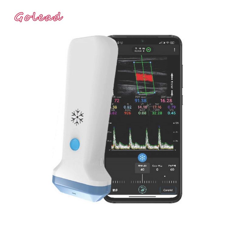 tipo inalámbrico escáner de la punta de prueba de 12MHz 3000mAh del ultrasonido para Iphone