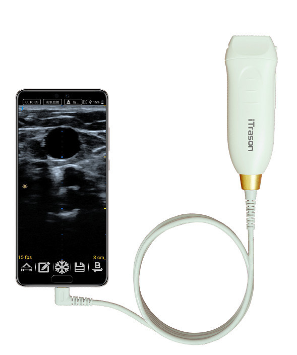 Escaner de ultrasonido portátil de profundidad de 20 mm para evaluación vascular periférica y acceso vascular guiado por ultrasonido