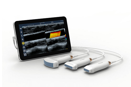Escáner de ultrasonido portátil lineal USB tipo C, sonda de ultrasonido portátil Android de 10MHz para Vascular y POCUS