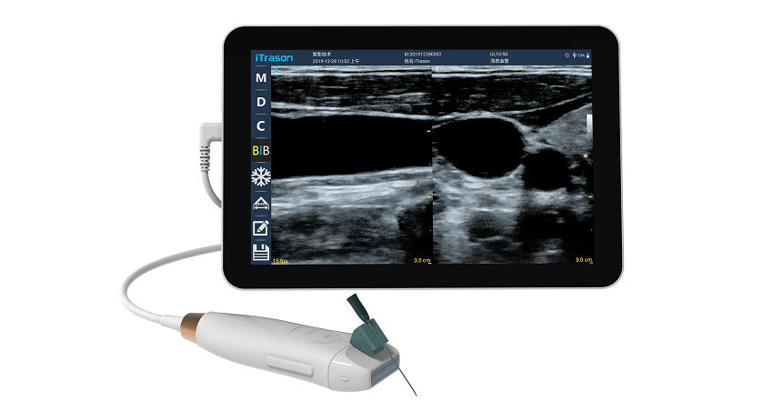 Escáner de ultrasonido portátil con sonda lineal de alta frecuencia de 12 MHz para procedimientos de acceso vascular y inserción PICC precisos