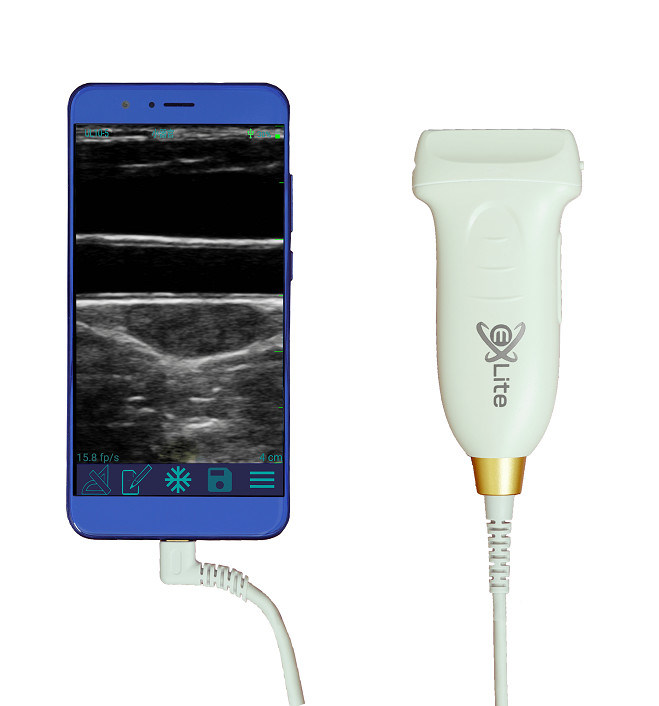 Escáner de ultrasonido portátil lineal USB tipo C, sonda de ultrasonido portátil Android de 10MHz para Vascular y POCUS