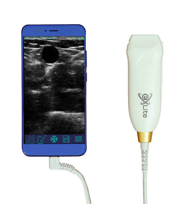 Escáner de ultrasonido portátil con sonda lineal de alta frecuencia de 12 MHz para procedimientos de acceso vascular y inserción PICC precisos