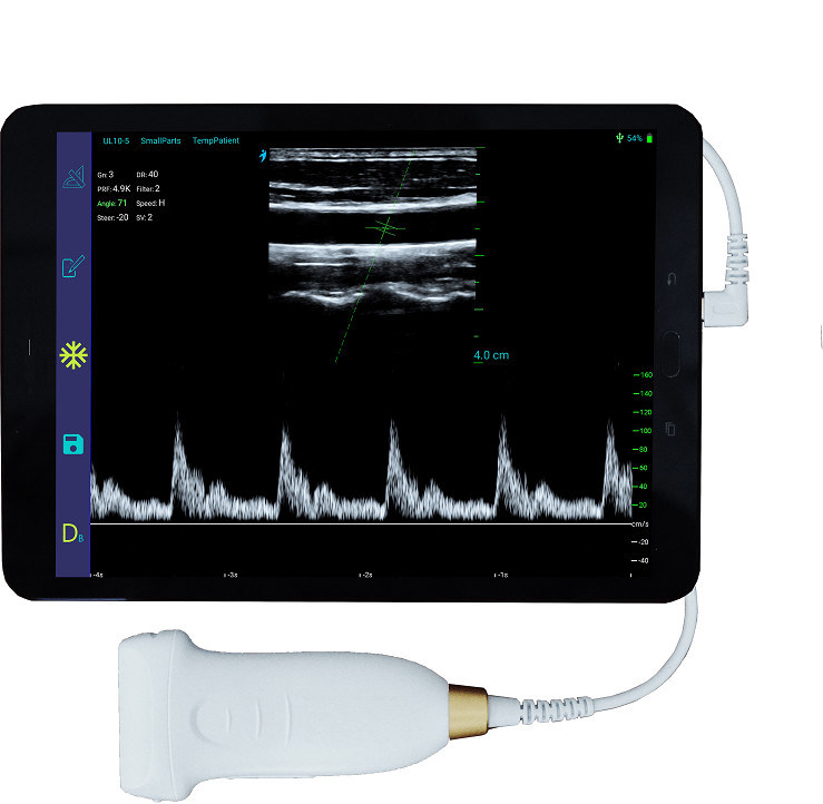 Escáner de ultrasonido portátil lineal USB tipo C, sonda de ultrasonido portátil Android de 10MHz para Vascular y POCUS