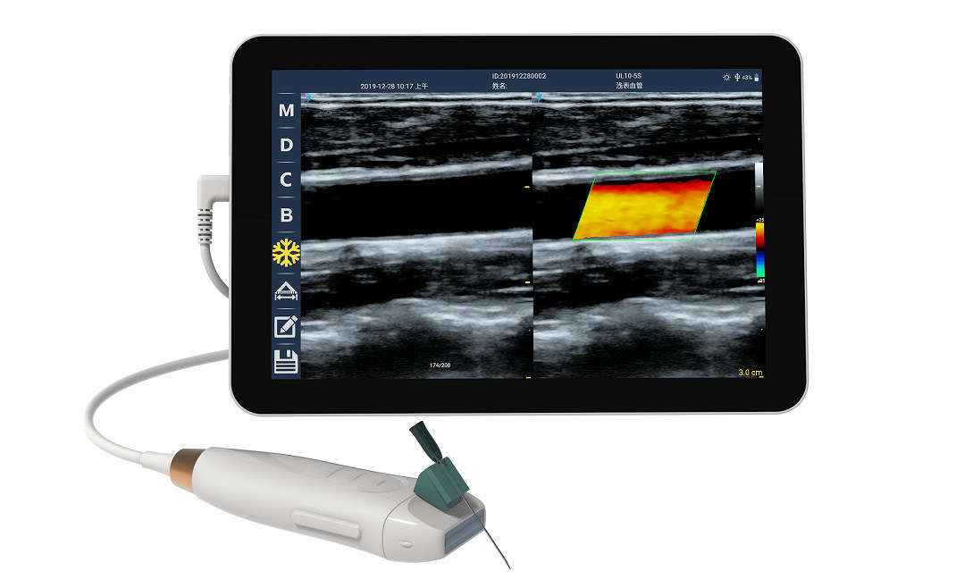 Escáner de ultrasonido portátil con sonda lineal de alta frecuencia de 12 MHz para procedimientos de acceso vascular y inserción PICC precisos