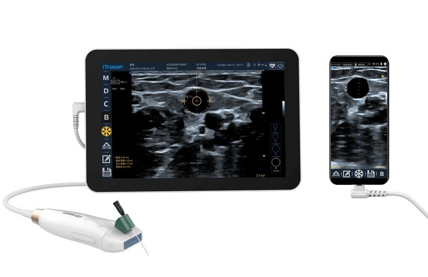 Escaner de ultrasonido portátil de profundidad de 20 mm para evaluación vascular periférica y acceso vascular guiado por ultrasonido