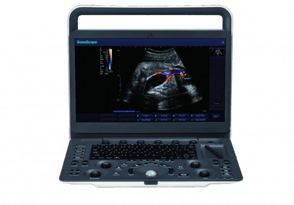 7 máquina portátil del ultrasonido de SonoScape E3 de los niveles de la proyección de imagen con el monitor de 15,6 pulgadas