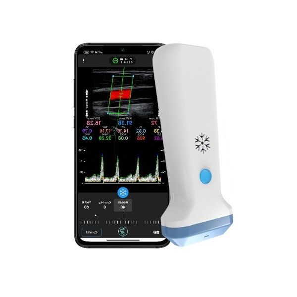escáner portátil del ultrasonido de Doppler del color del 12.6cm para los profesionales de la atención sanitaria