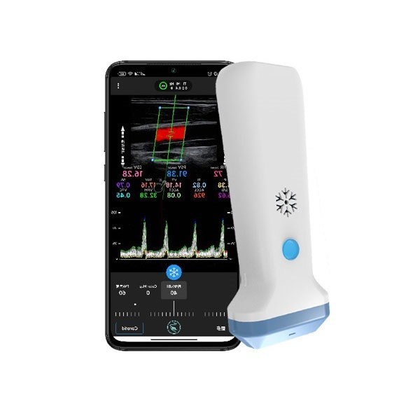 Escáner de ultrasonido lineal inalámbrico Doppler color portátil, ultrasonido POCUS portátil de 12,6 cm para profesionales de la salud